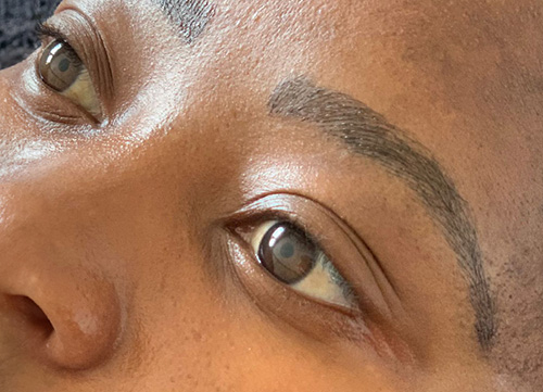 07-Belle Skin and Artistry After Microblading
