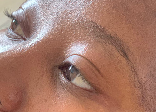 07- Belle Skin and Artistry Before Microblading