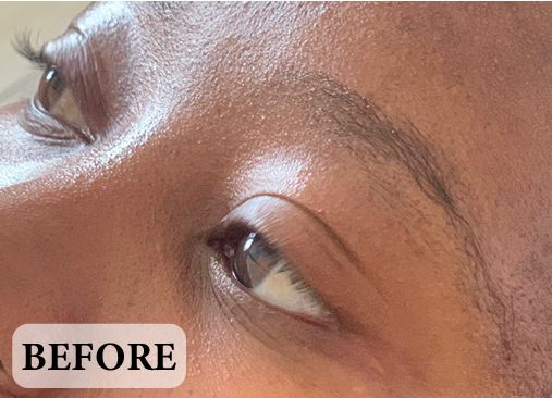 Microblading-Before